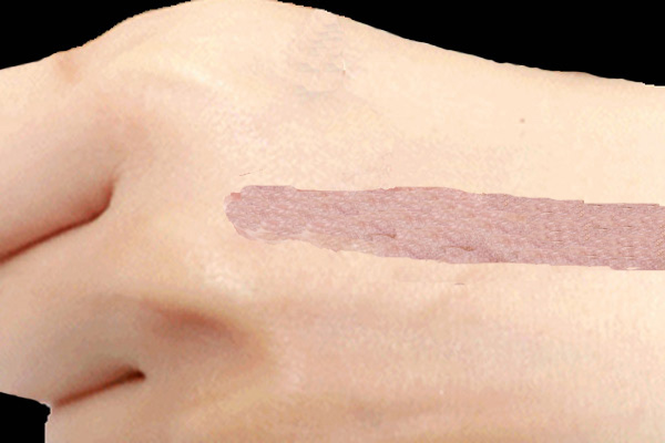 便攜式分光測色儀用于皮膚挫傷的檢測與顏色分析